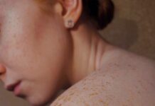 여름철 피부 건강, 올바른 관리법으로 지키세요 topless woman with brown hair